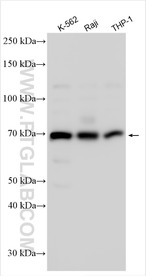 Western Blot (WB) analysis of various lysates using IKZF4 Polyclonal antibody (31094-1-AP)