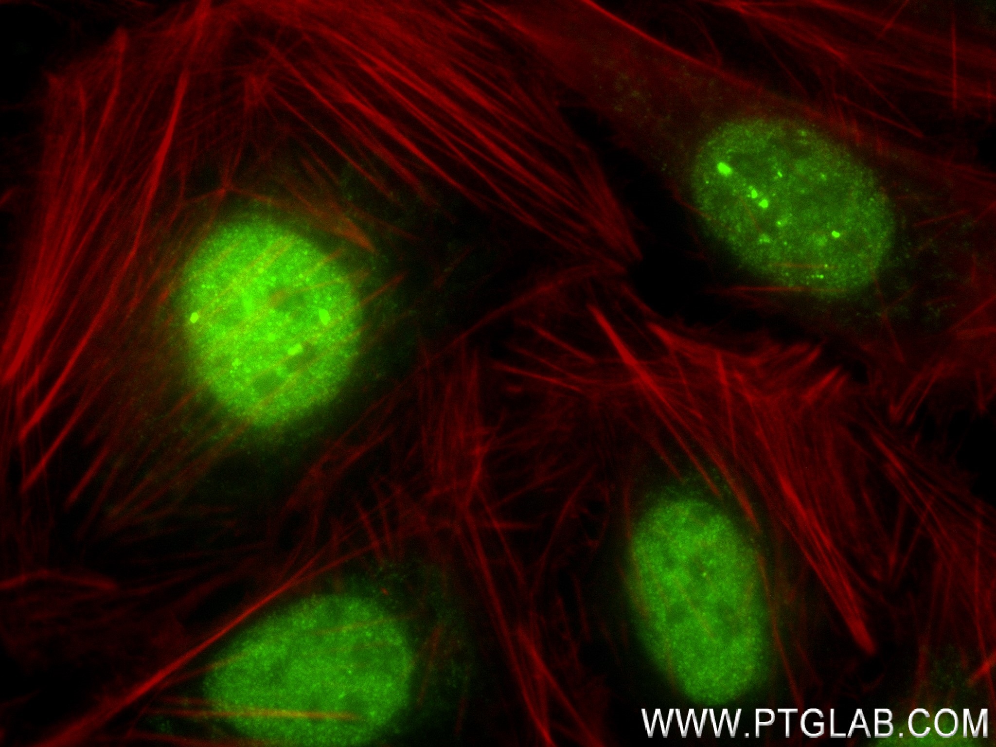 Immunofluorescence (IF) / fluorescent staining of U2OS cells using IKZF4 Recombinant antibody (83471-5-RR)