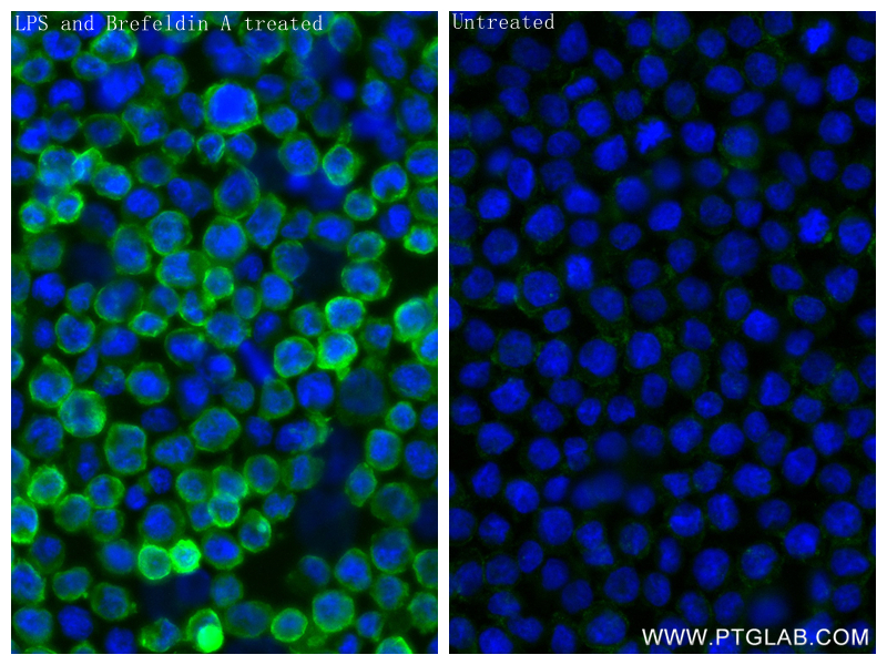 Immunofluorescence (IF) / fluorescent staining of THP-1 cells using IL-1 beta Recombinant antibody (82696-15-RR)