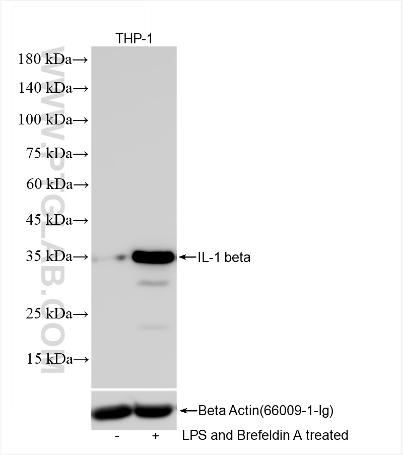 Western Blot (WB) analysis of THP-1 cells using IL-1 beta  Recombinant antibody (82696-17-RR)