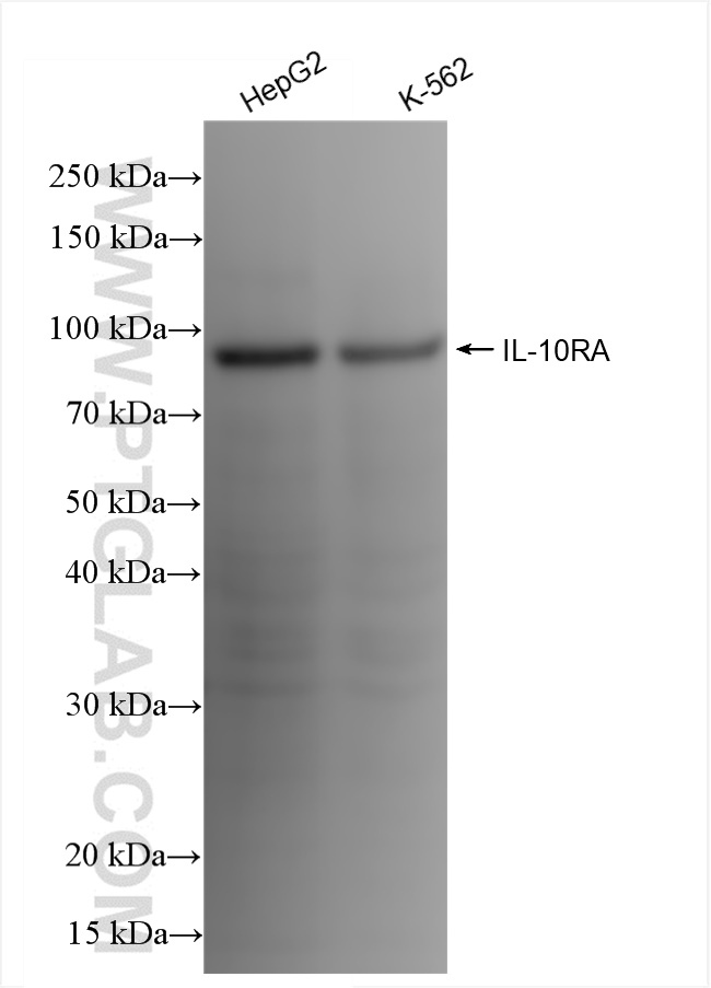 Western Blot (WB) analysis of various lysates using IL-10RA Recombinant antibody (84428-3-RR)