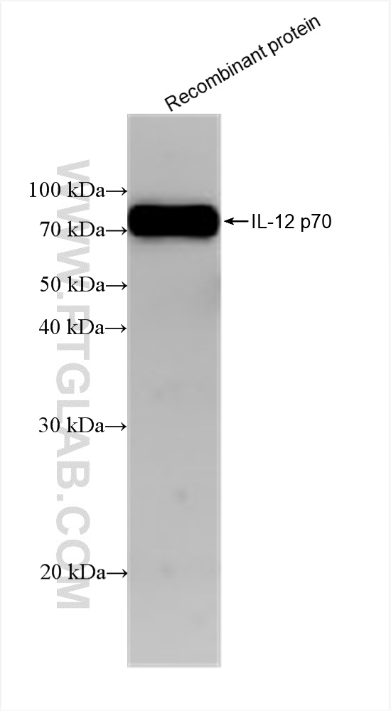 Western Blot (WB) analysis of various lysates using IL-12 Recombinant antibody (83094-1-RR)