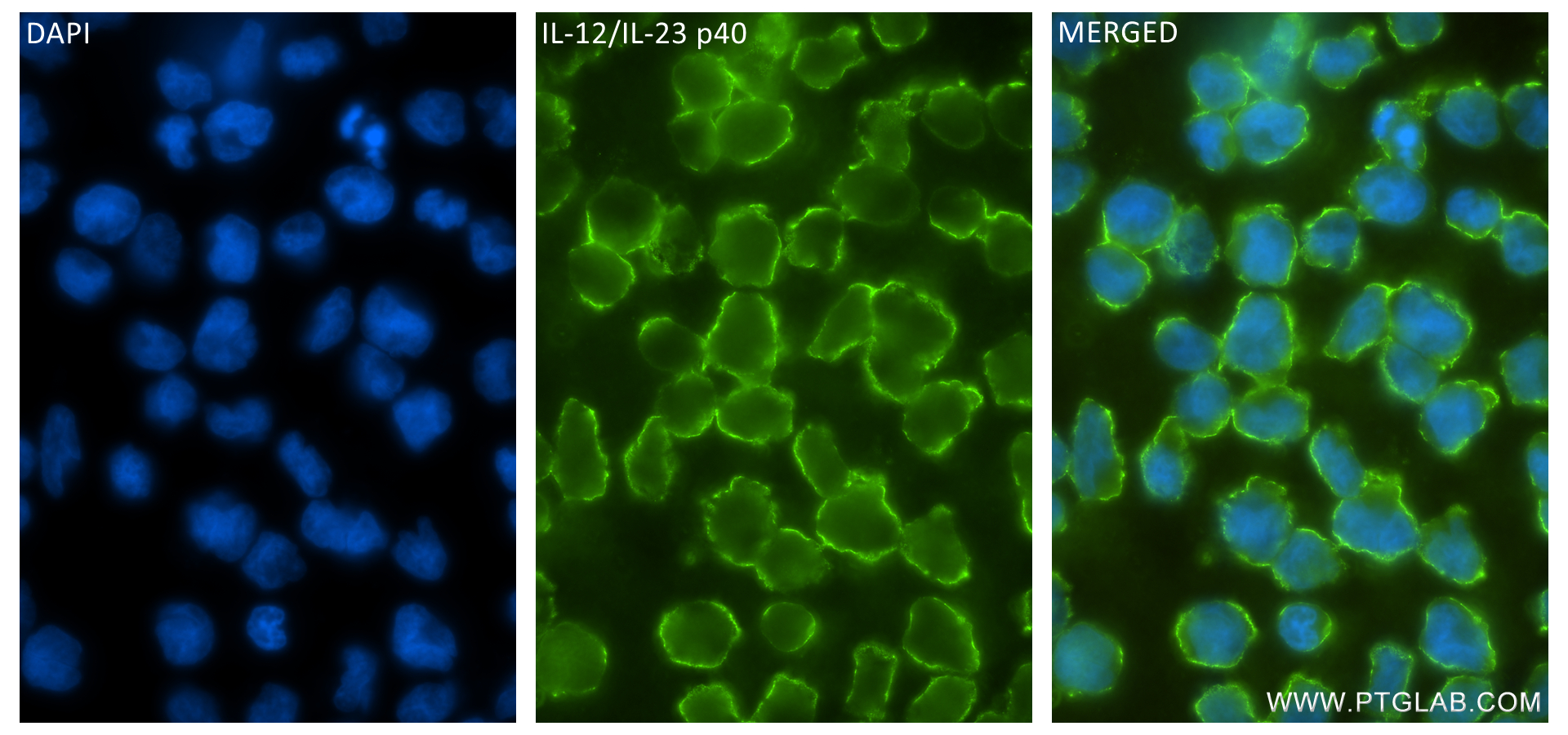 Immunofluorescence (IF) / fluorescent staining of MOLT-4 cells using IL-12/IL-23 p40 Recombinant antibody (83008-7-RR)