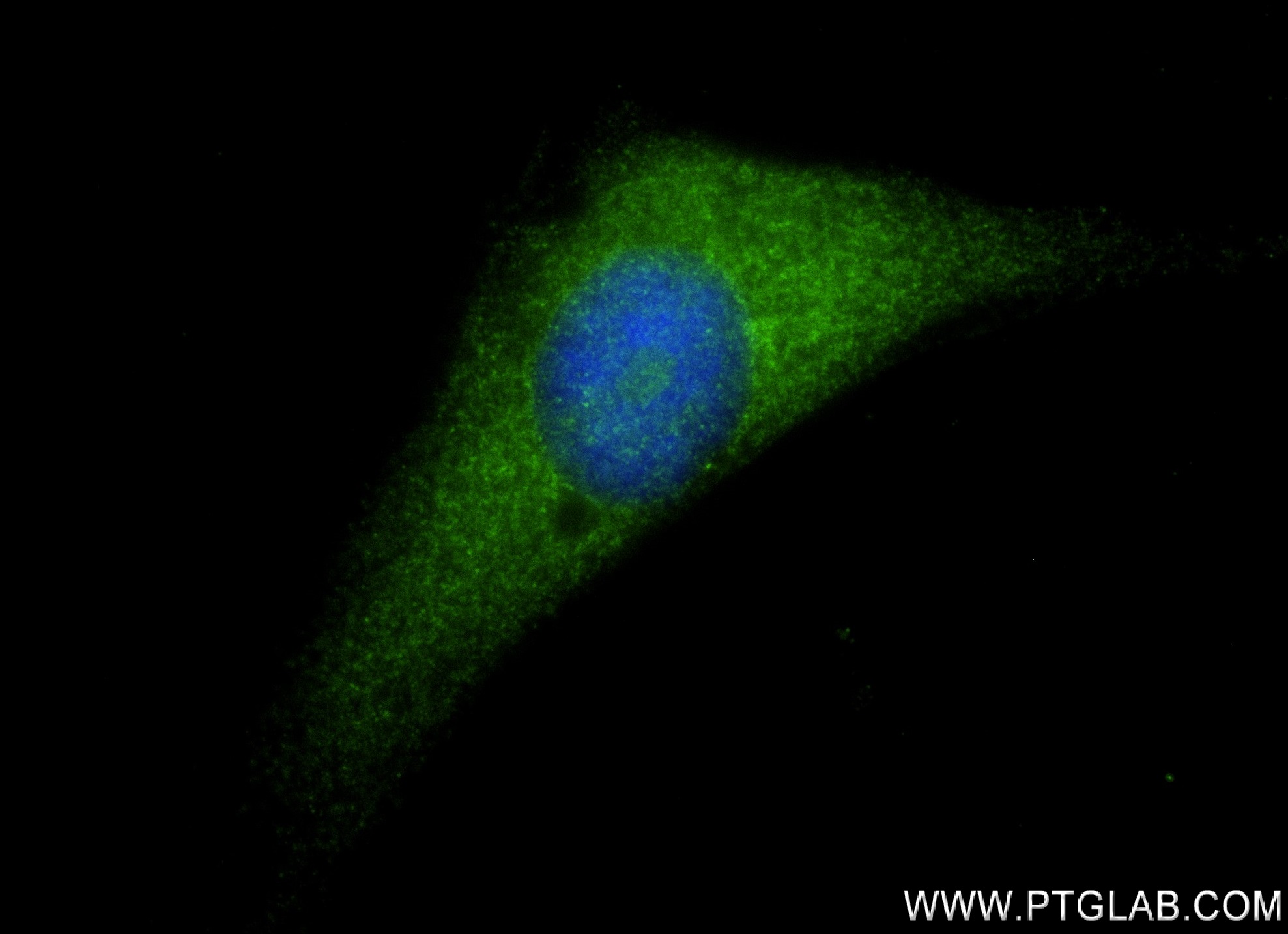 Immunofluorescence (IF) / fluorescent staining of HeLa cells using IL-18 Recombinant antibody (82907-1-RR)