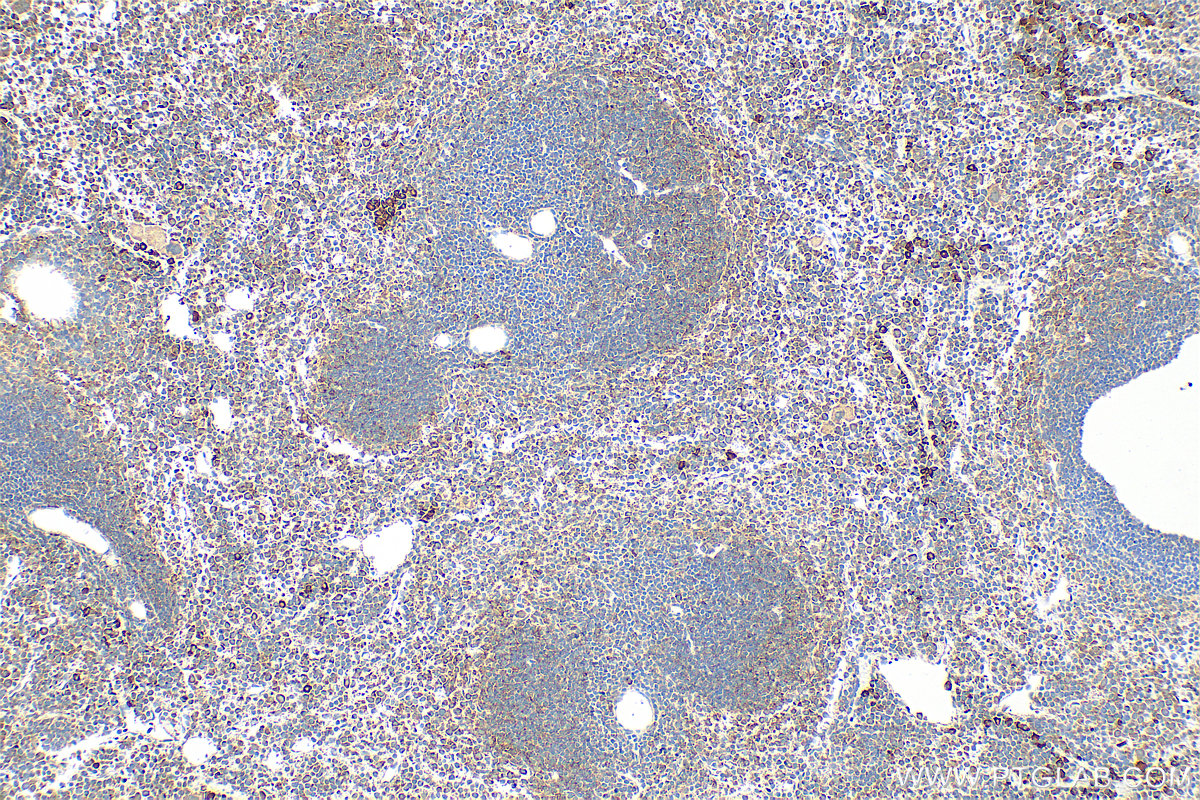 Immunohistochemistry (IHC) staining of mouse spleen tissue using IL-1R1 Polyclonal antibody (27348-1-AP)