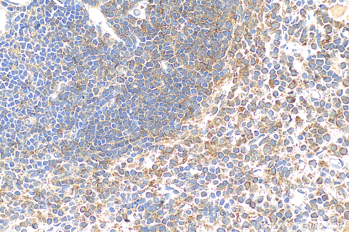 Immunohistochemistry (IHC) staining of mouse spleen tissue using IL-1R1 Polyclonal antibody (27348-1-AP)