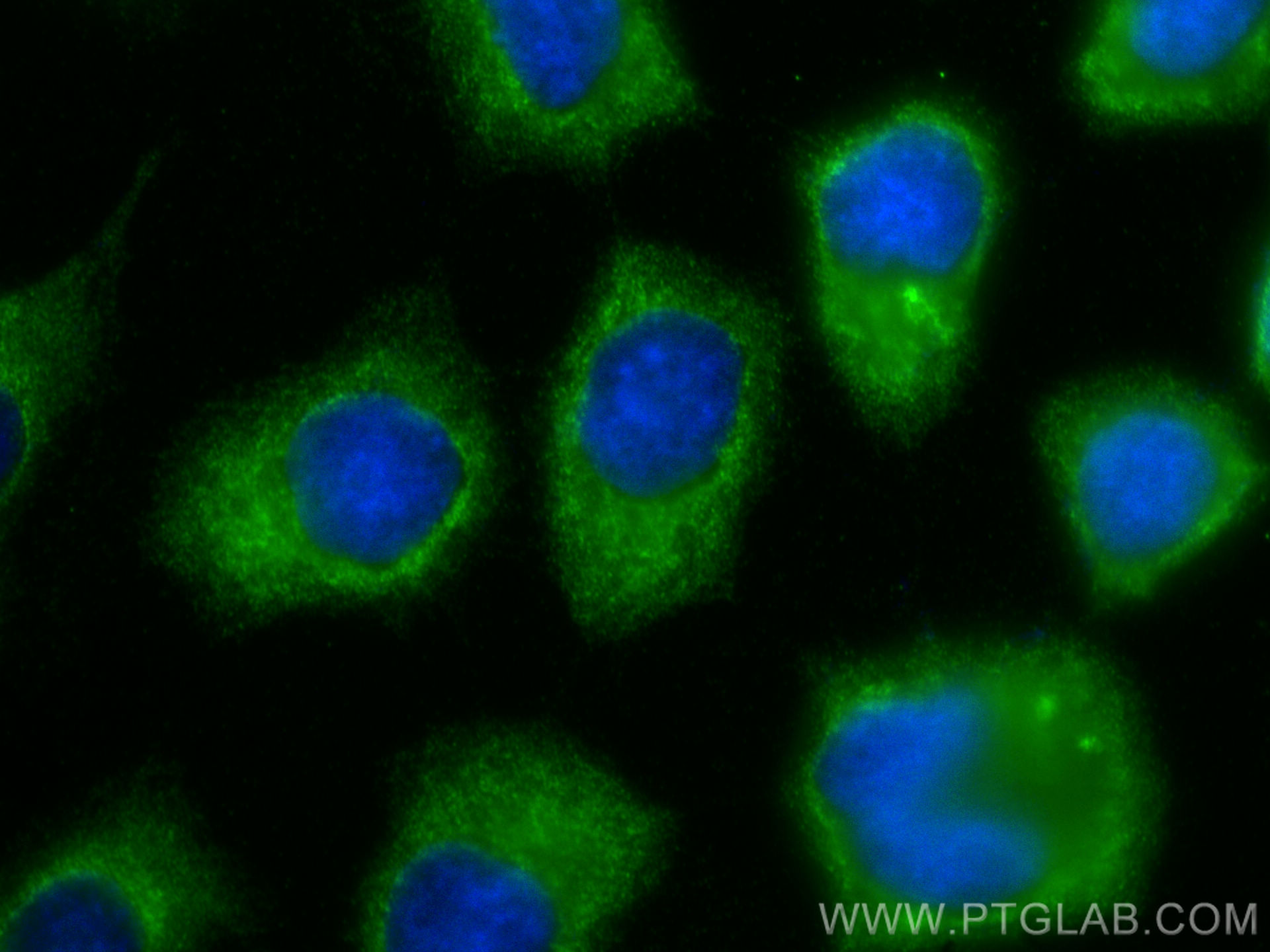 Immunofluorescence (IF) / fluorescent staining of A431 cells using IL-1RA  Polyclonal antibody (31127-1-AP)