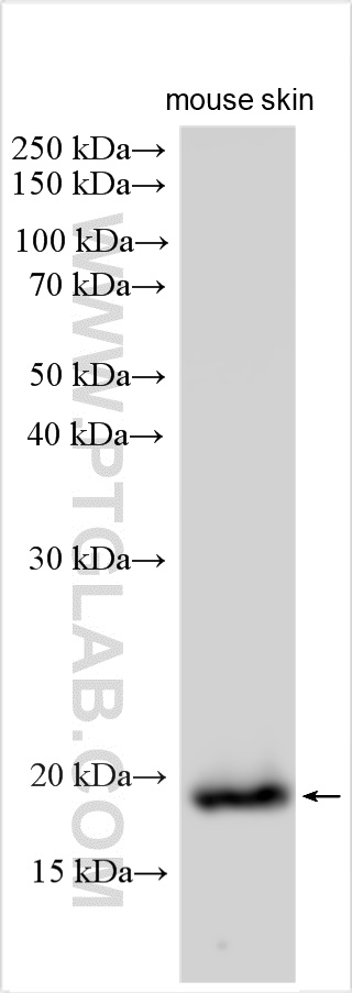 Western Blot (WB) analysis of various lysates using mouse IL-1RN Polyclonal antibody (31127-1-AP)