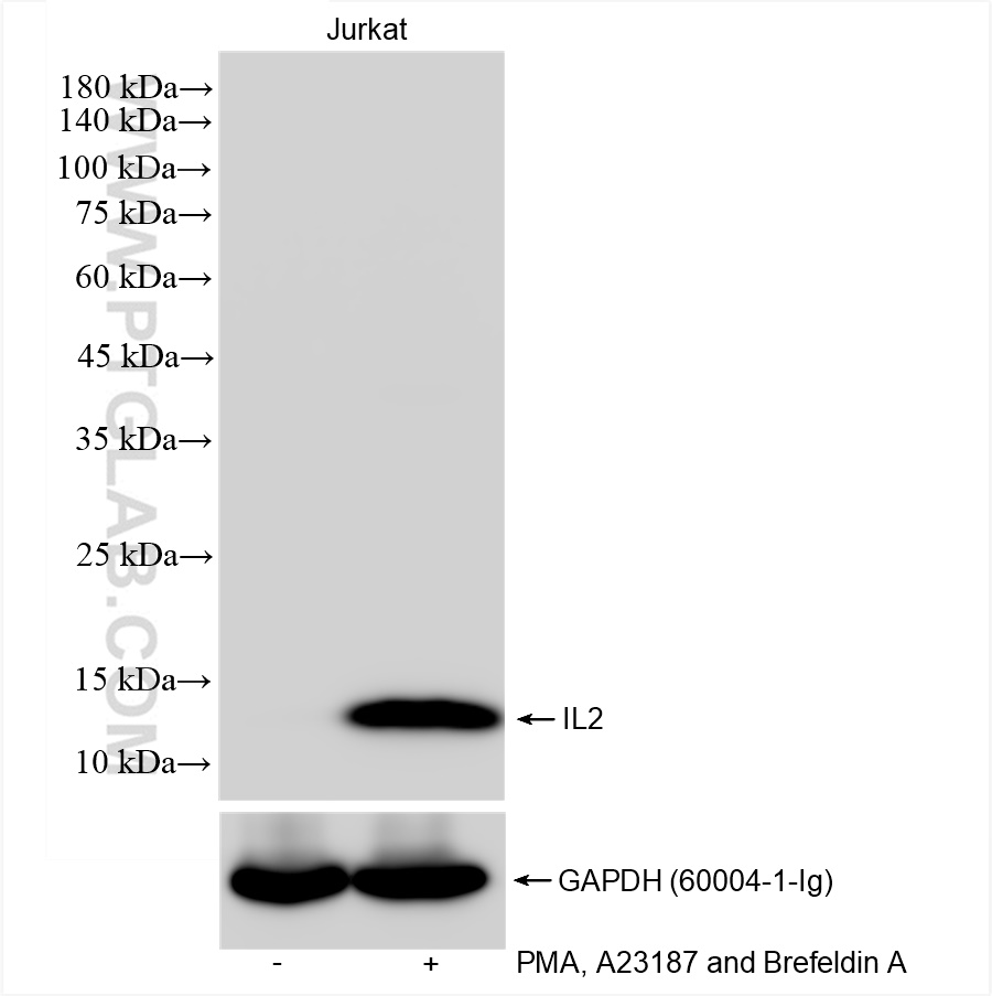 Western Blot (WB) analysis of various lysates using IL-2 Recombinant antibody (83558-5-RR)