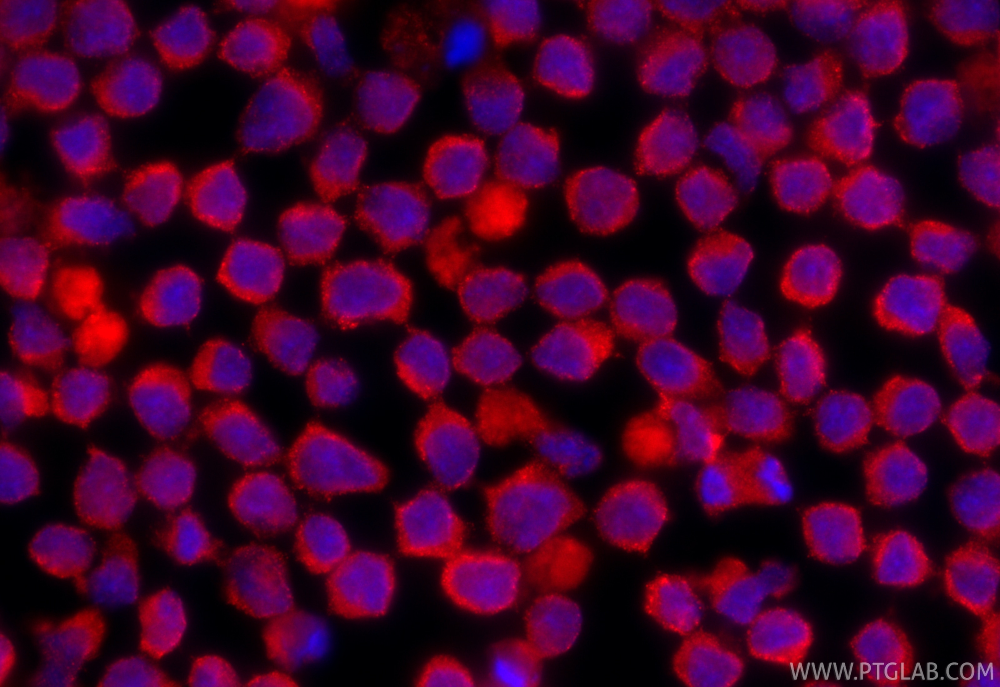 Immunofluorescence (IF) / fluorescent staining of Ramos cells using CoraLite®594-conjugated IL-4 Monoclonal antibody (CL594-66142)