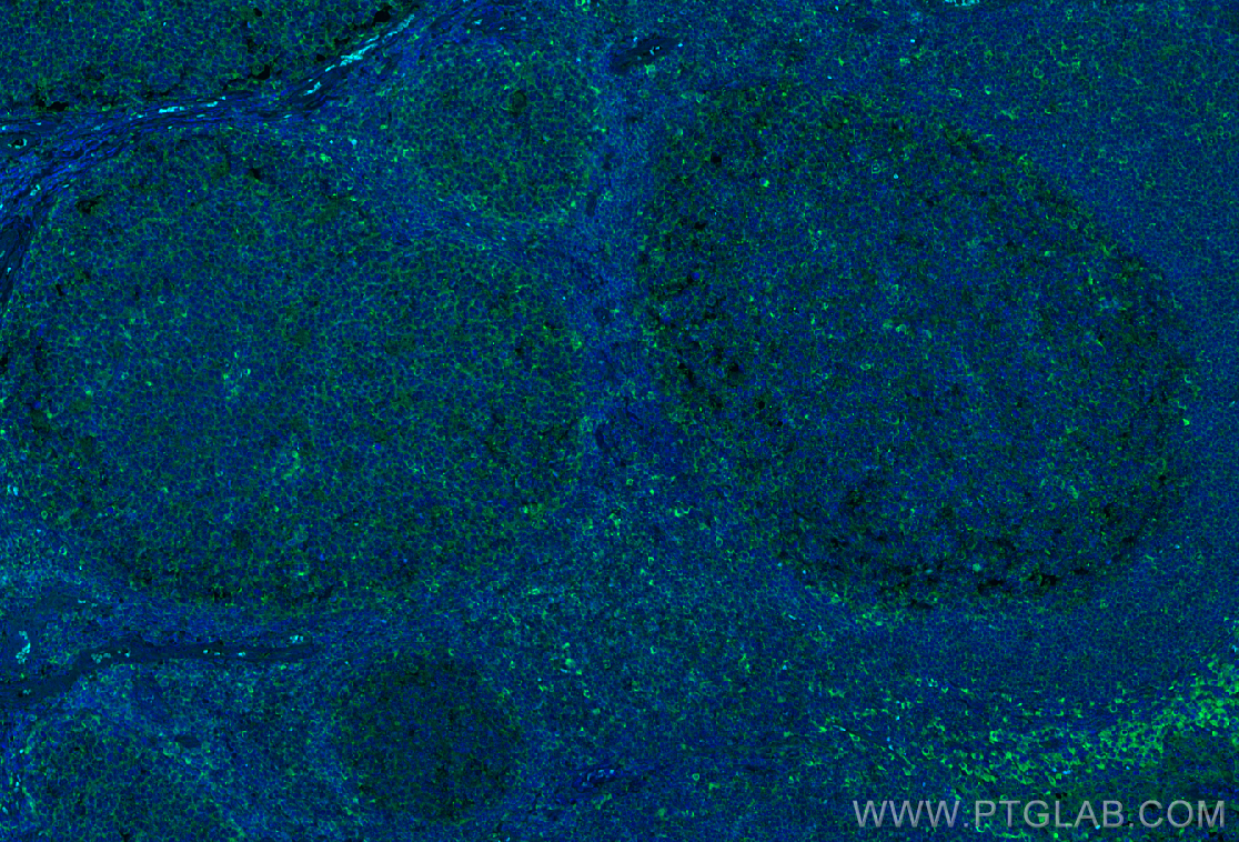 Immunofluorescence (IF) / fluorescent staining of human tonsillitis tissue using CoraLite® Plus 488-conjugated IL-4RA/CD124 Monoclo (CL488-67051)