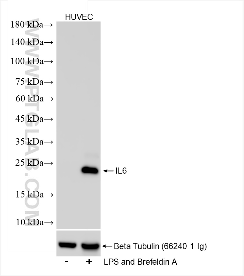 Western Blot (WB) analysis of HUVEC cells using IL-6 Recombinant antibody (83747-5-RR)