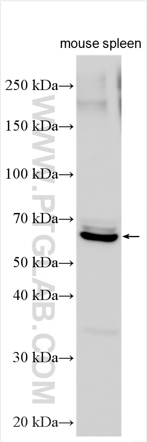Western Blot (WB) analysis of various lysates using IL-7Ra/CD127 Polyclonal antibody (31773-1-AP)