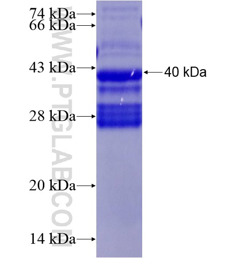 IL-11RA fusion protein Ag28360 SDS-PAGE