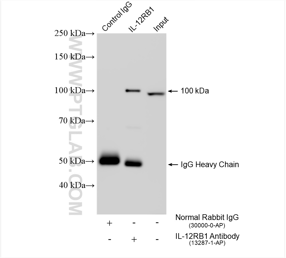 Immunoprecipitation (IP) experiment of K-562 cells using IL-12RB1 Polyclonal antibody (13287-1-AP)