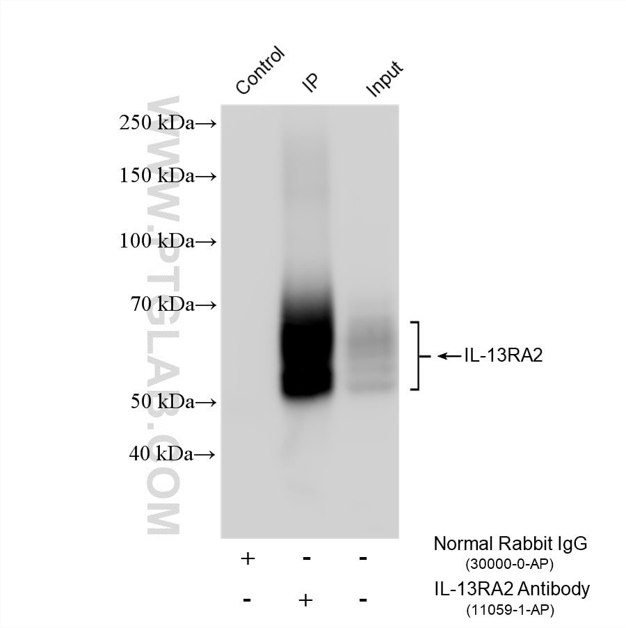 Immunoprecipitation (IP) experiment of A375 cells using IL-13RA2 Polyclonal antibody (11059-1-AP)