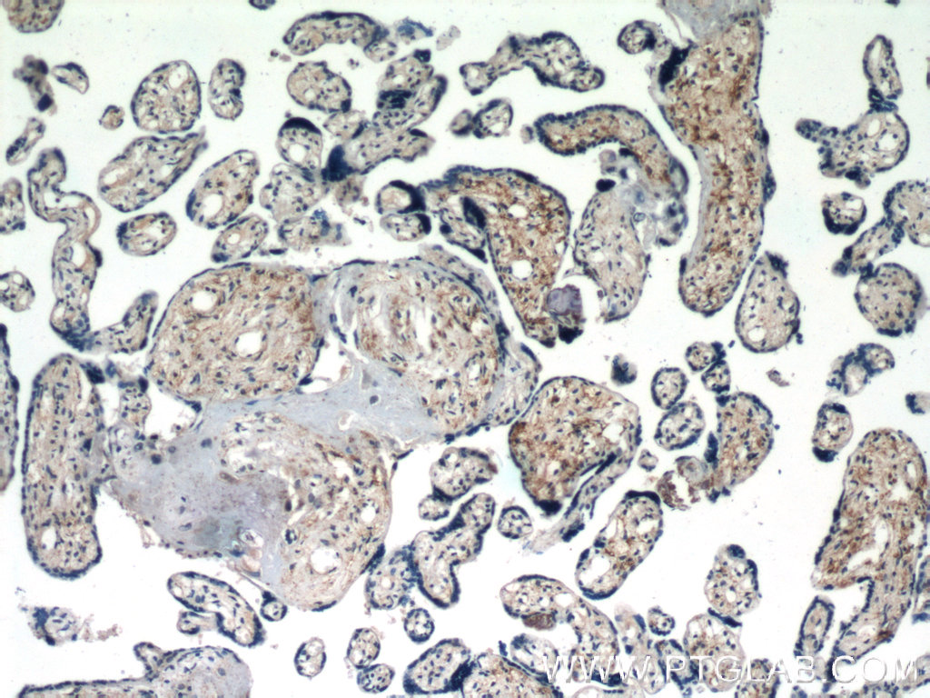 Immunohistochemistry (IHC) staining of human placenta tissue using IL-15 Polyclonal antibody (12962-1-AP)