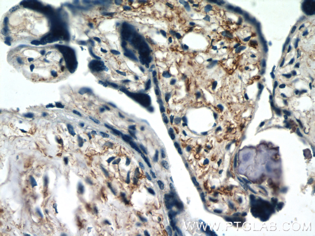 Immunohistochemistry (IHC) staining of human placenta tissue using IL-15 Polyclonal antibody (12962-1-AP)