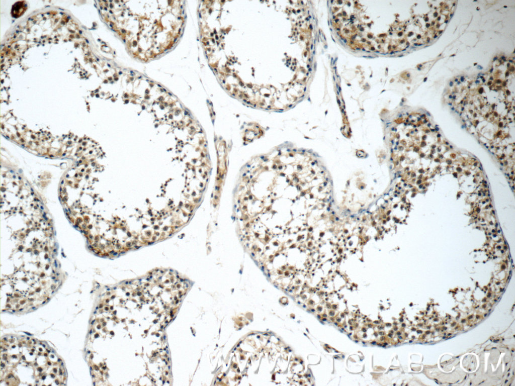 Immunohistochemistry (IHC) staining of human testis tissue using IL-15 Polyclonal antibody (12962-1-AP)