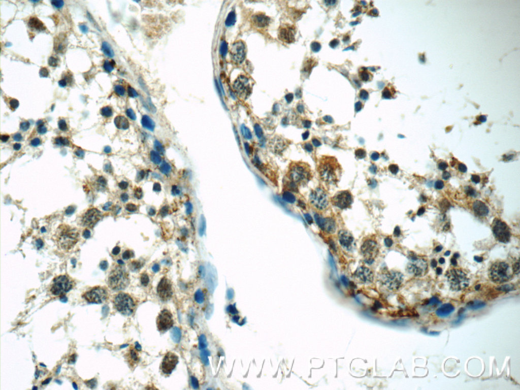 Immunohistochemistry (IHC) staining of human testis tissue using IL-15 Polyclonal antibody (12962-1-AP)