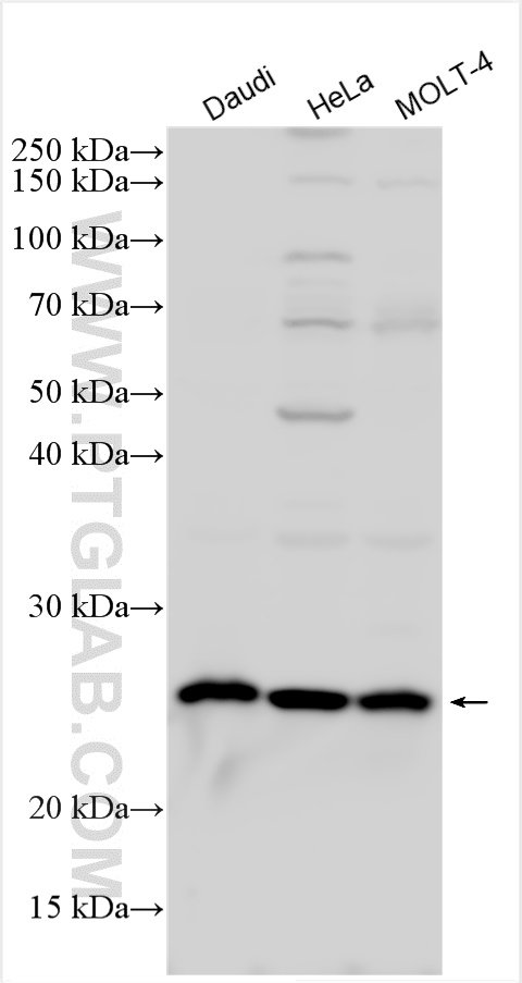 Western Blot (WB) analysis of various lysates using IL-17B Polyclonal antibody (24495-1-AP)