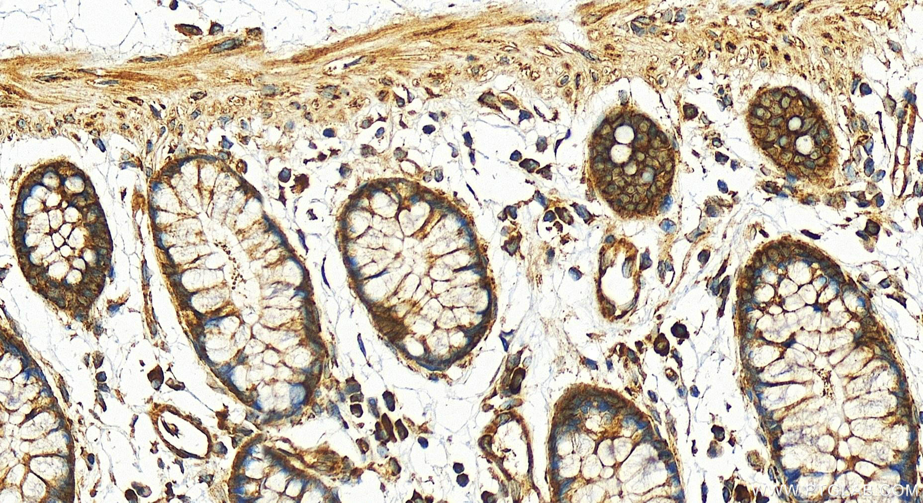 Immunohistochemistry (IHC) staining of human colon tissue using IL-17RB Polyclonal antibody (20673-1-AP)