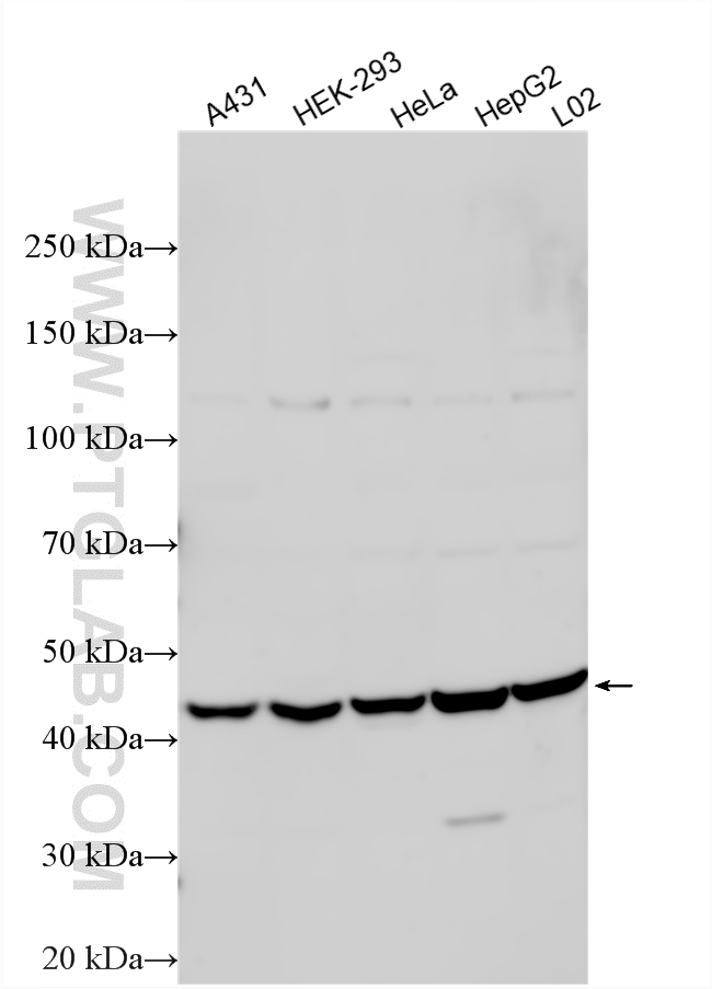 Western Blot (WB) analysis of various lysates using IL-17RC Polyclonal antibody (15648-1-AP)