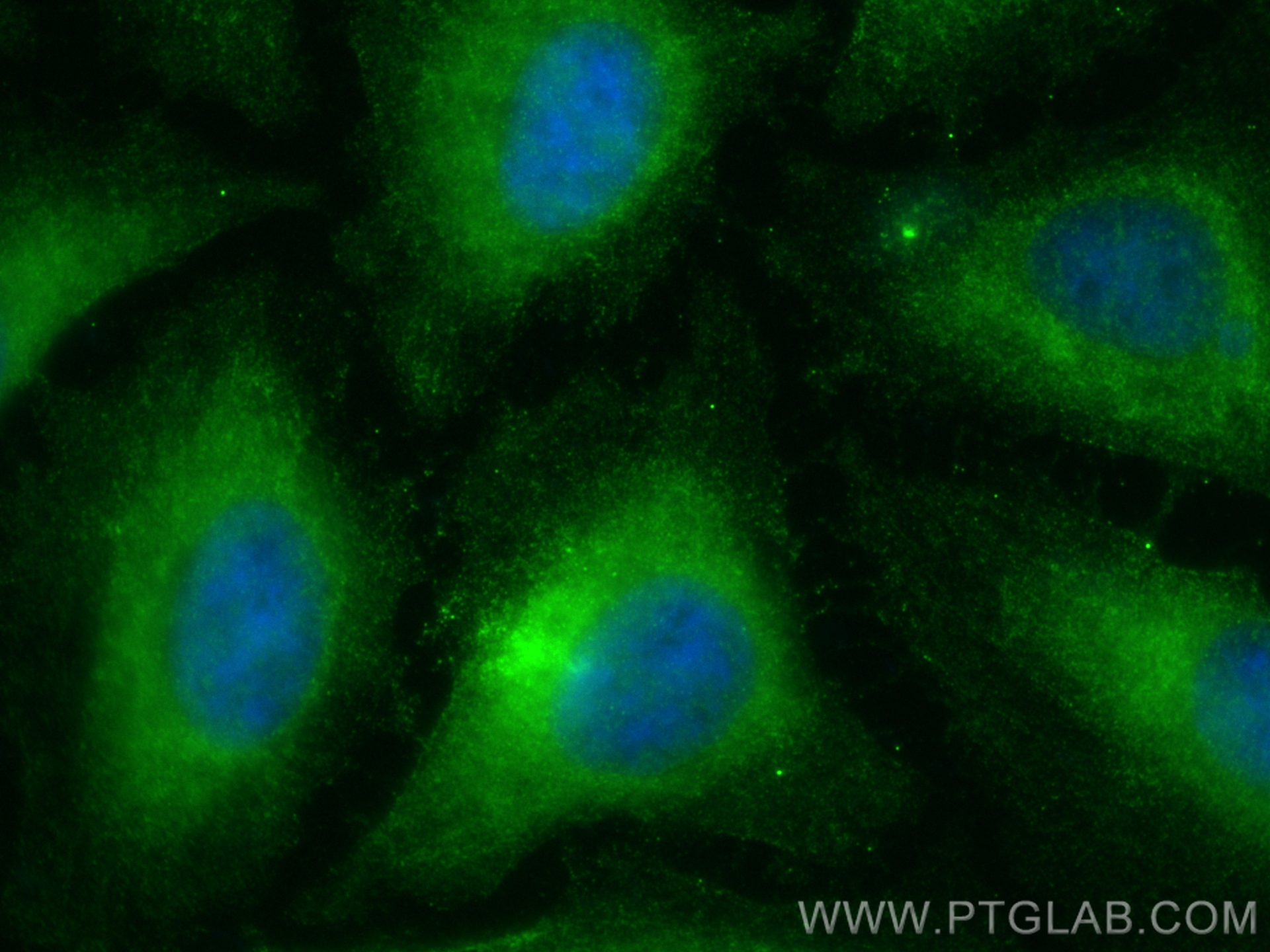 Immunofluorescence (IF) / fluorescent staining of HeLa cells using IL-18 Monoclonal antibody (60070-1-Ig)