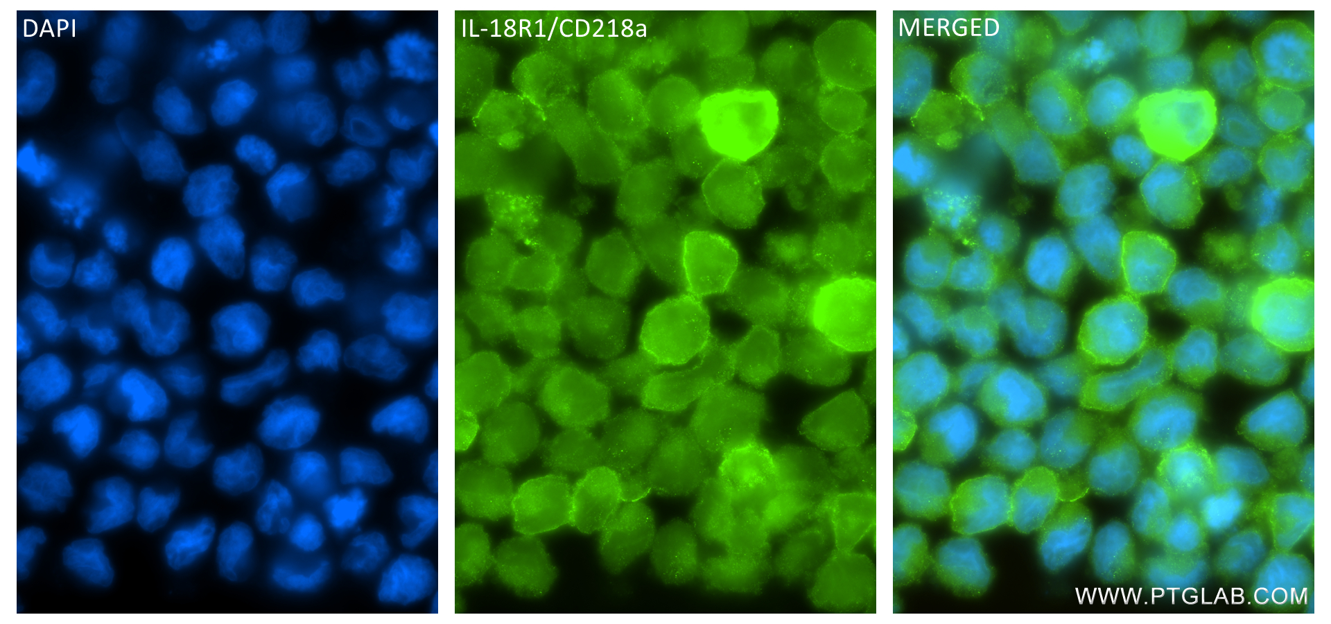 Immunofluorescence (IF) / fluorescent staining of NK-92 cells using IL-18R1/CD218a Recombinant antibody (84390-5-RR)