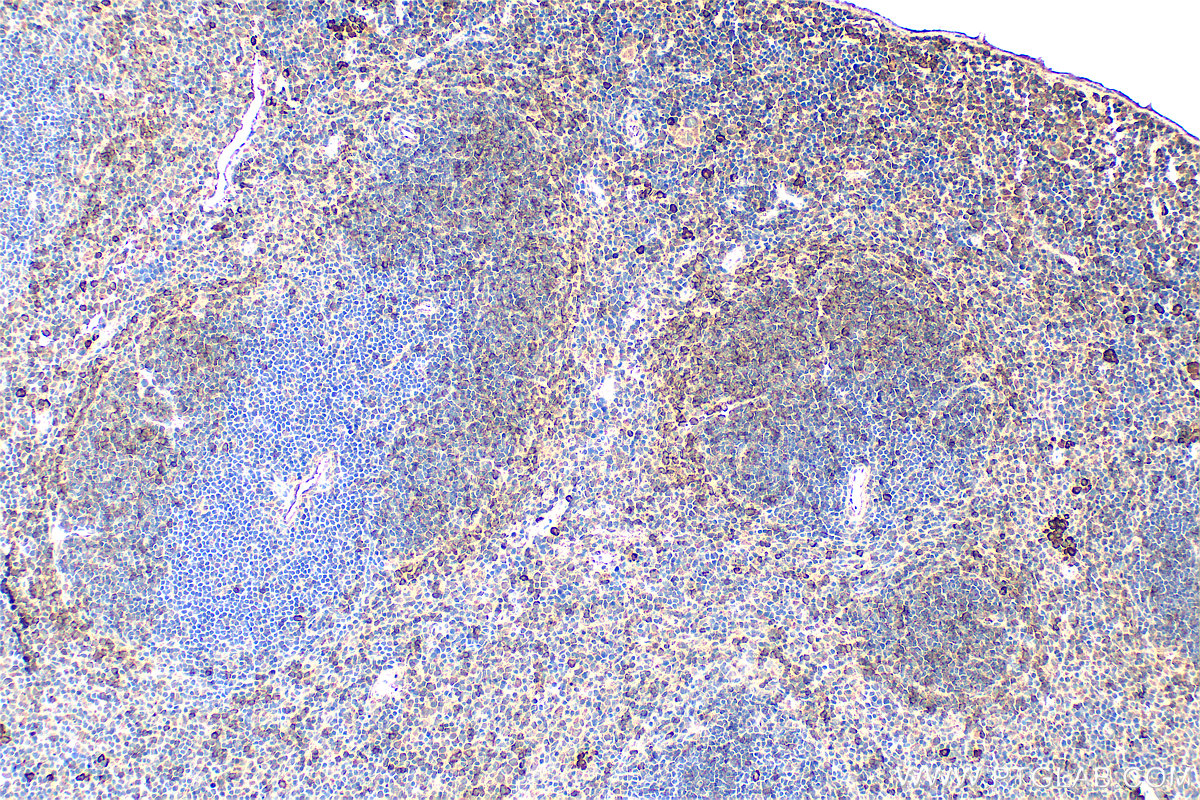 Immunohistochemistry (IHC) staining of mouse spleen tissue using IL18RAP Polyclonal antibody (30587-1-AP)