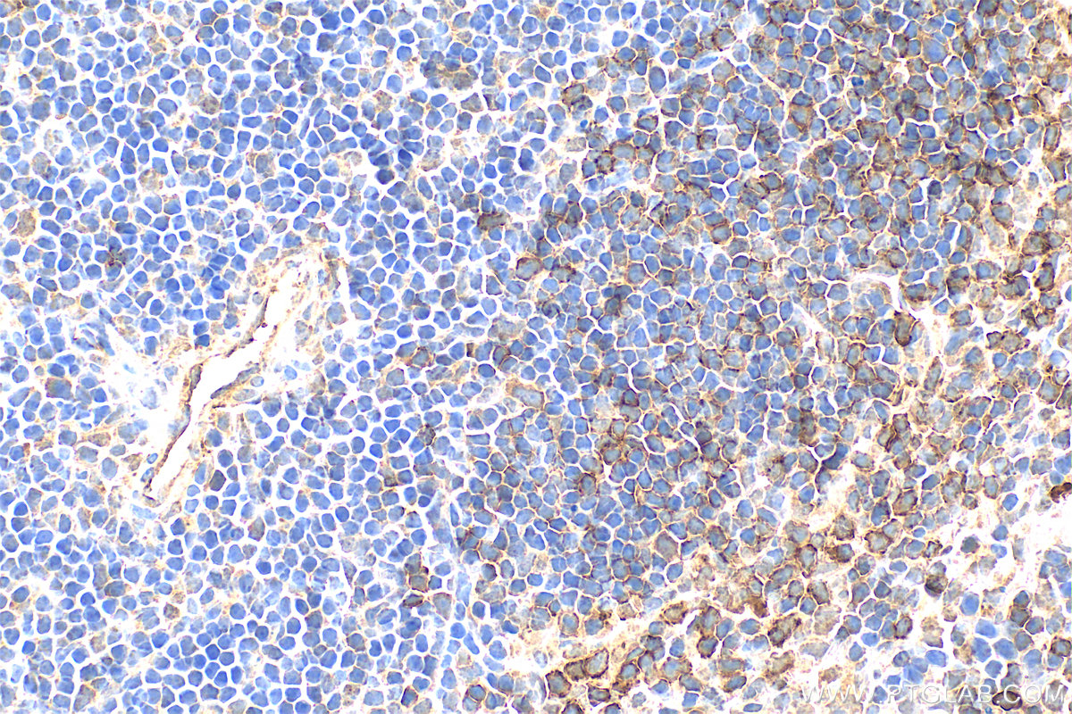 Immunohistochemistry (IHC) staining of mouse spleen tissue using IL18RAP Polyclonal antibody (30587-1-AP)