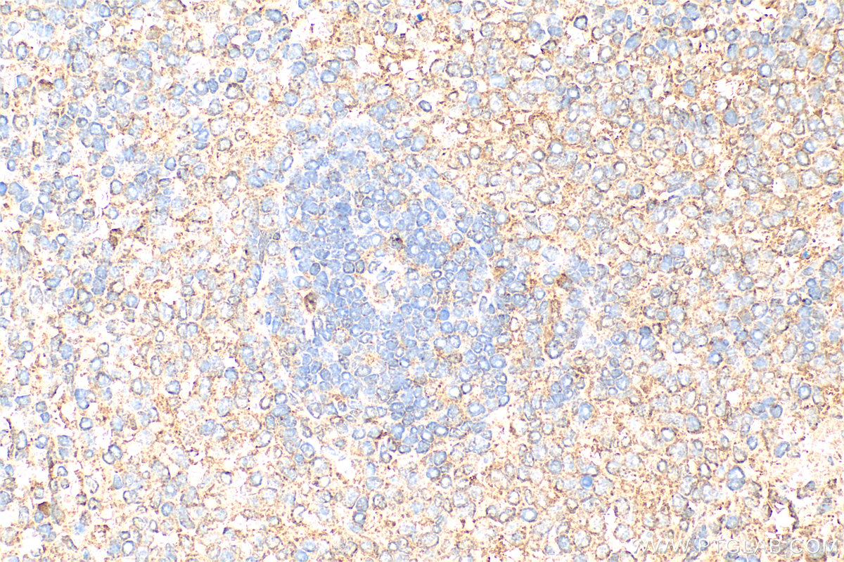 Immunohistochemistry (IHC) staining of rat spleen tissue using IL18RAP Polyclonal antibody (30587-1-AP)