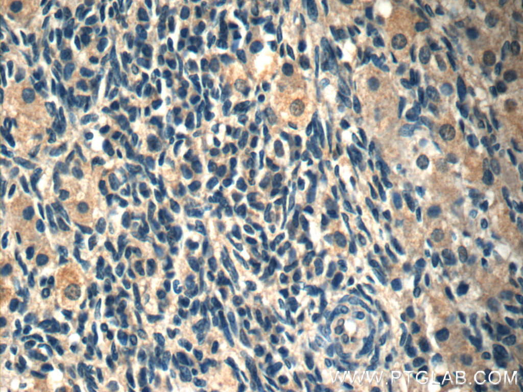 Immunohistochemistry (IHC) staining of human ovary tissue using IL-36 Gamma Monoclonal antibody (60248-1-Ig)