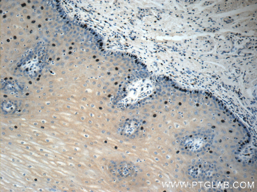 Immunohistochemistry (IHC) staining of human oesophagus tissue using IL-36 Gamma Monoclonal antibody (60248-1-Ig)