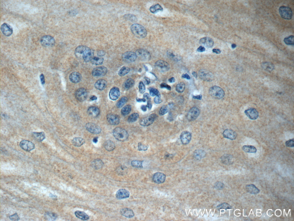 Immunohistochemistry (IHC) staining of human oesophagus tissue using IL-36 Gamma Monoclonal antibody (60248-1-Ig)