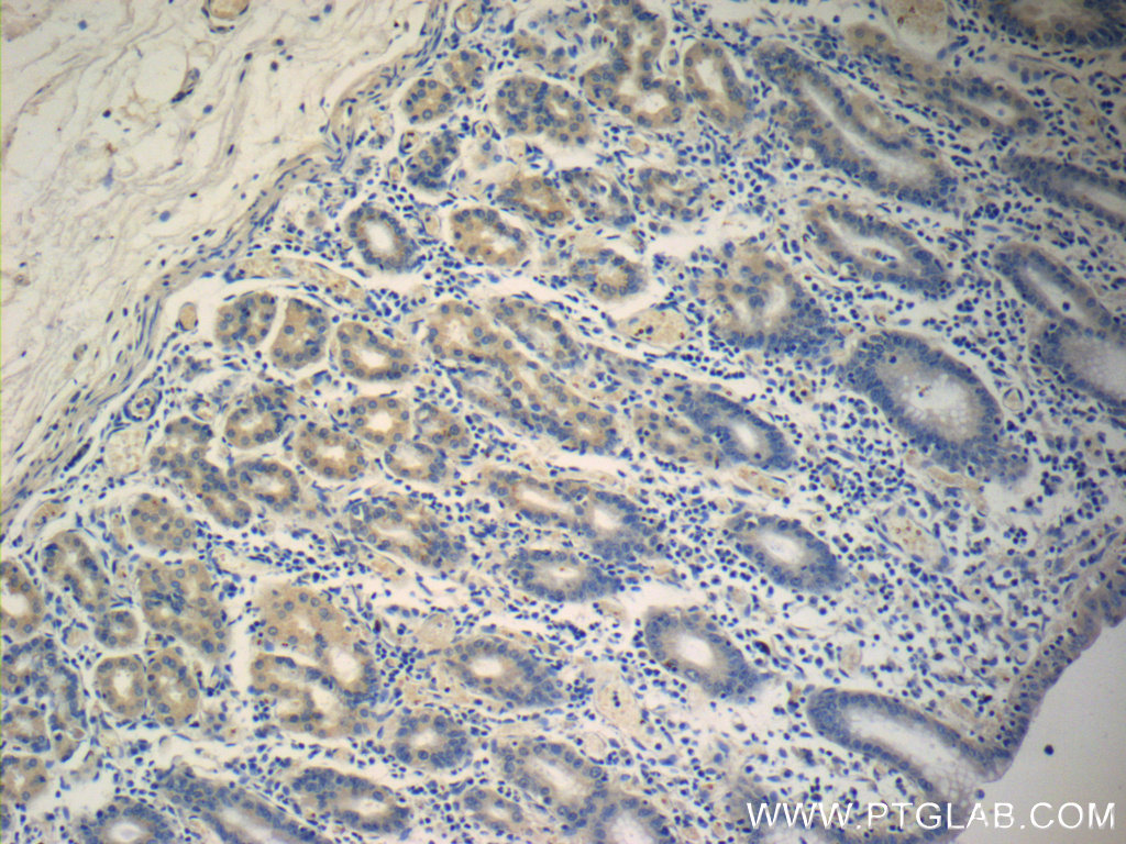 Immunohistochemistry (IHC) staining of human stomach tissue using IL-36 Gamma Monoclonal antibody (60248-1-Ig)