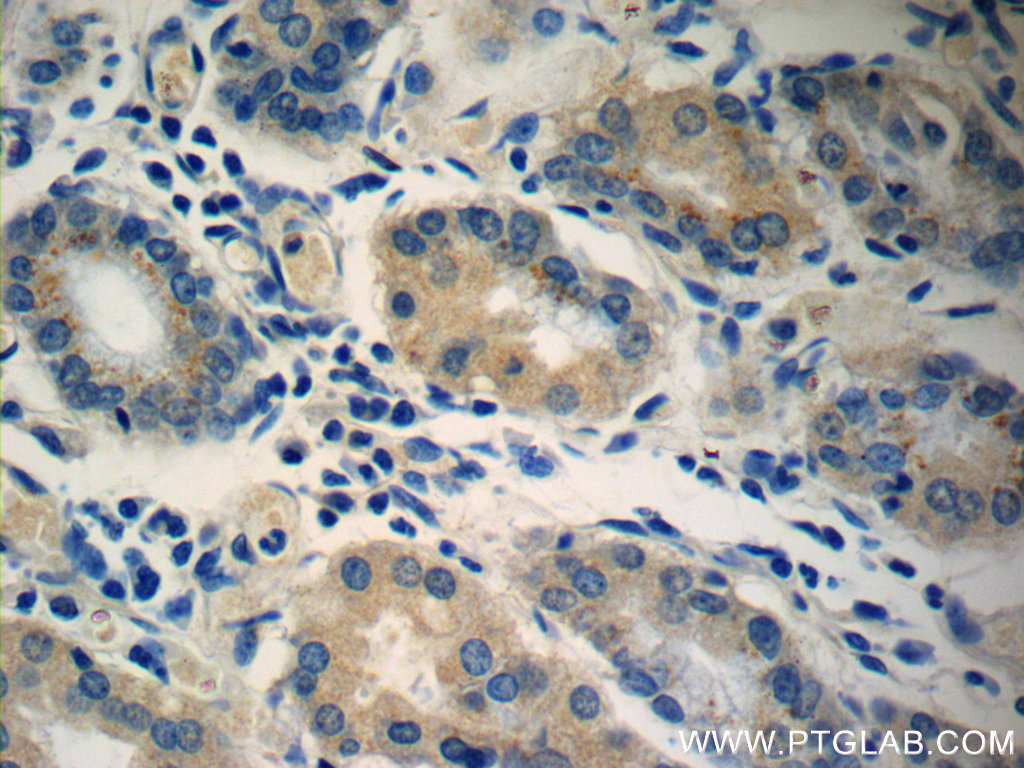 Immunohistochemistry (IHC) staining of human stomach tissue using IL-36 Gamma Monoclonal antibody (60248-1-Ig)