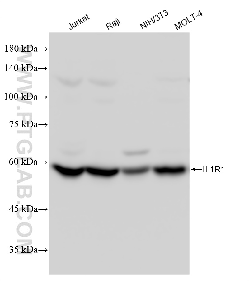 Western Blot (WB) analysis of various lysates using IL1R1 Recombinant antibody (83420-1-RR)