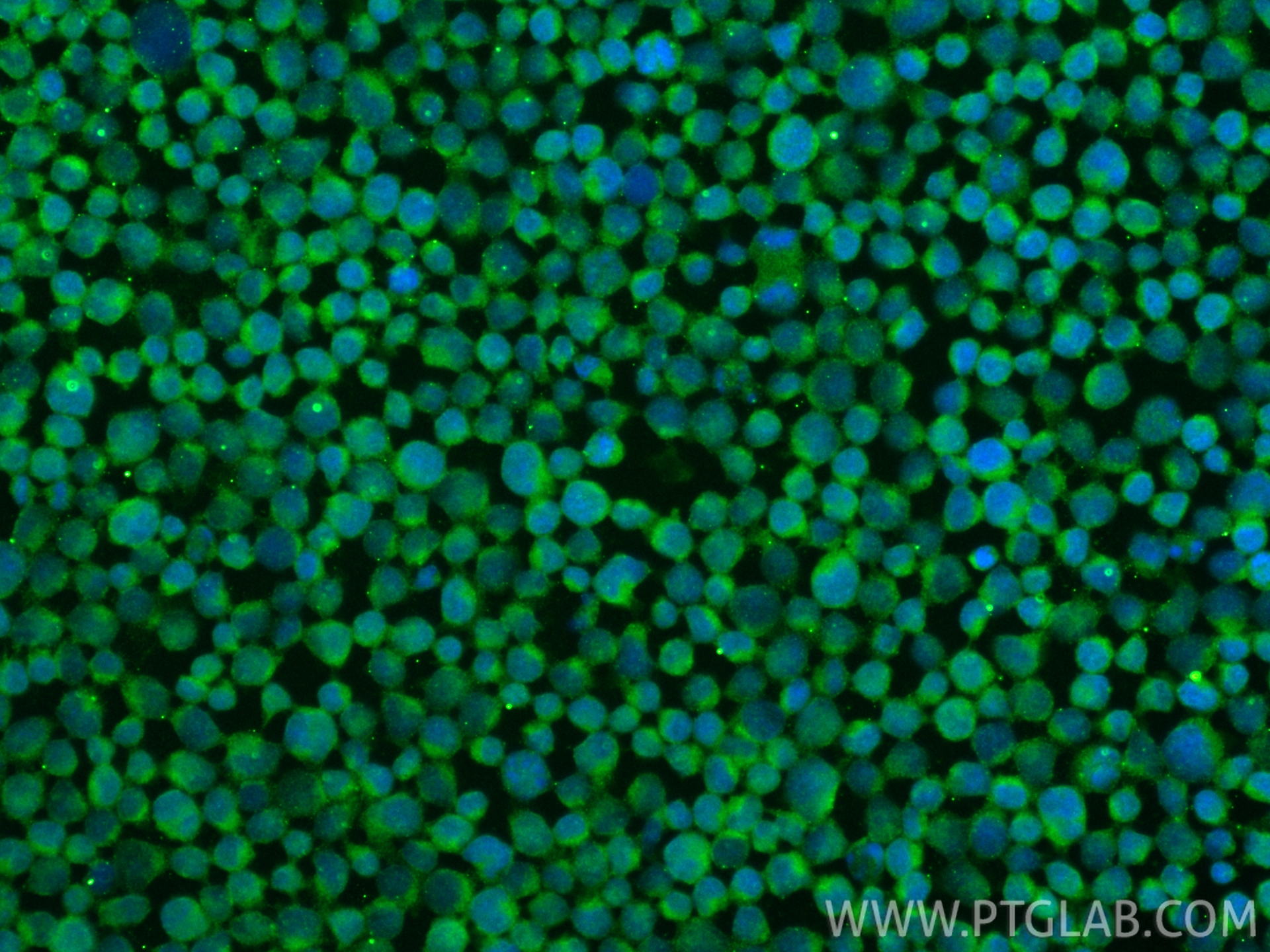 Immunofluorescence (IF) / fluorescent staining of Jurkat cells using IL-1R2 Monoclonal antibody (60262-1-Ig)