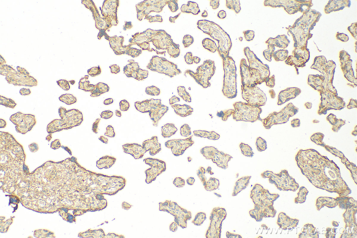 Immunohistochemistry (IHC) staining of human placenta tissue using IL-1RAP Polyclonal antibody (30966-1-AP)