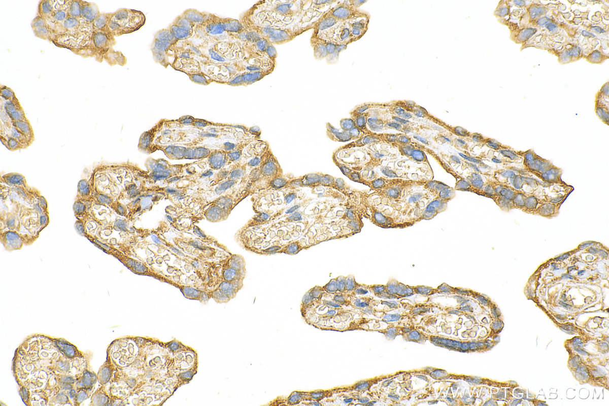 Immunohistochemistry (IHC) staining of human placenta tissue using IL-1RAP Polyclonal antibody (30966-1-AP)