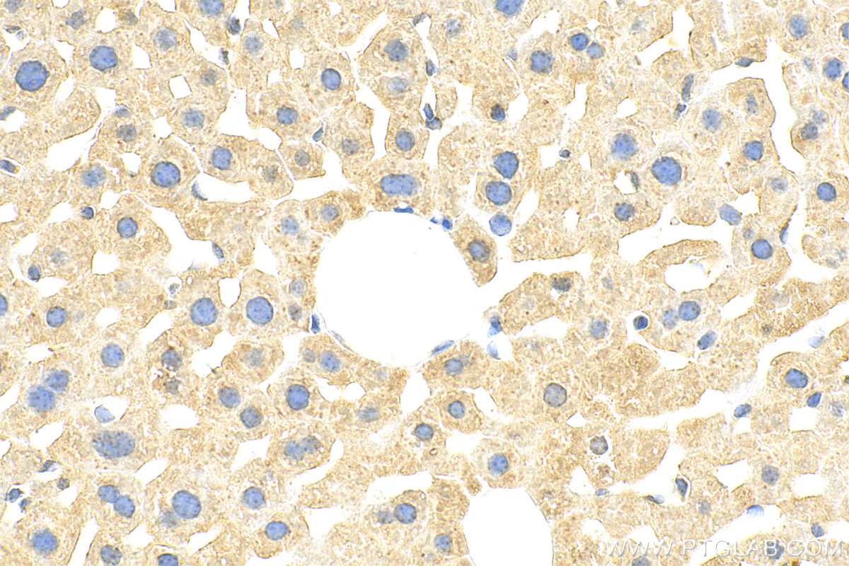 Immunohistochemistry (IHC) staining of mouse liver tissue using IL-1RAP Polyclonal antibody (30966-1-AP)