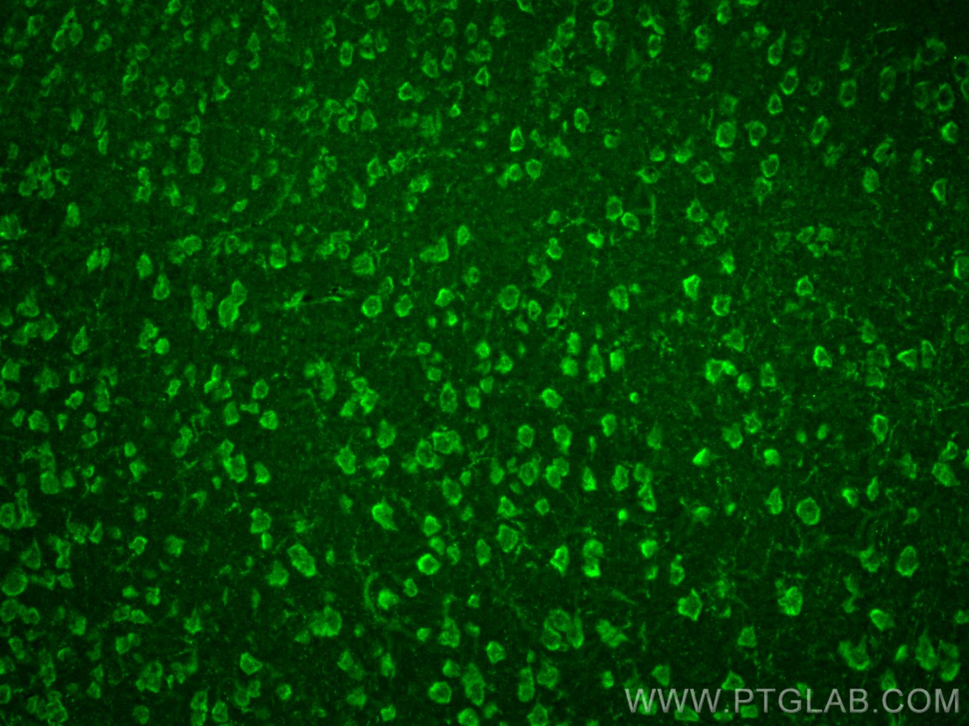 Immunofluorescence (IF) / fluorescent staining of mouse brain tissue using IL-1-RAPL-1 Polyclonal antibody (21609-1-AP)