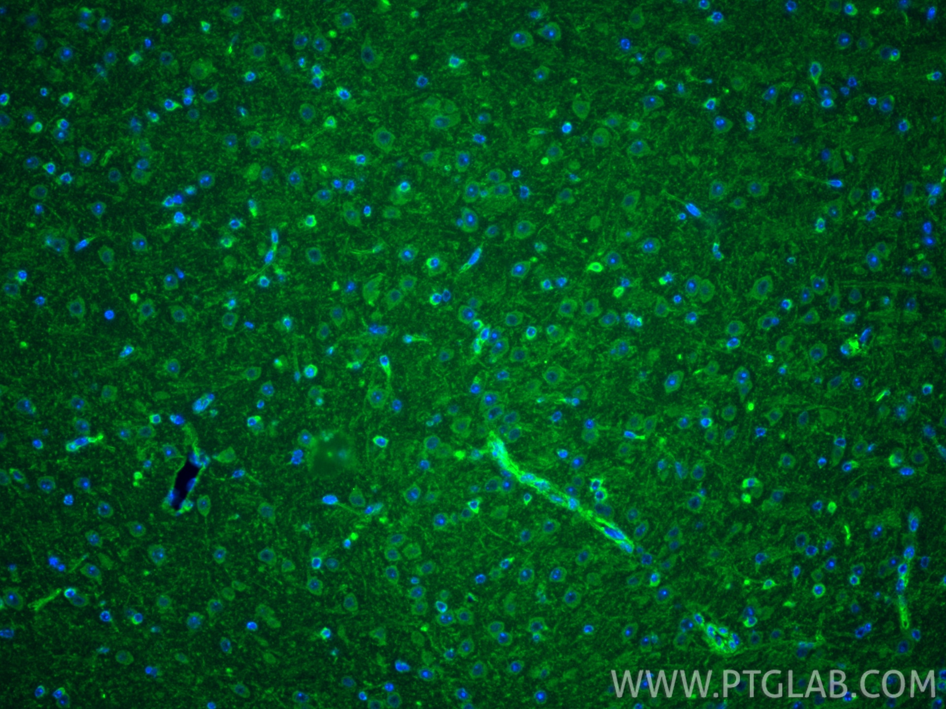 Immunofluorescence (IF) / fluorescent staining of mouse brain tissue using IL-1RL1/ST2 Polyclonal antibody (11920-1-AP)