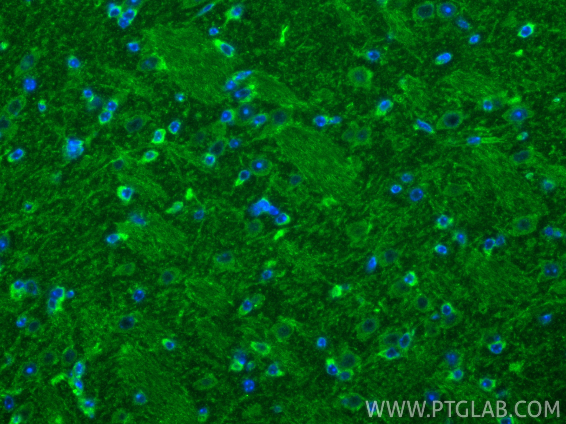 Immunofluorescence (IF) / fluorescent staining of mouse brain tissue using IL-1RL1/ST2 Polyclonal antibody (11920-1-AP)