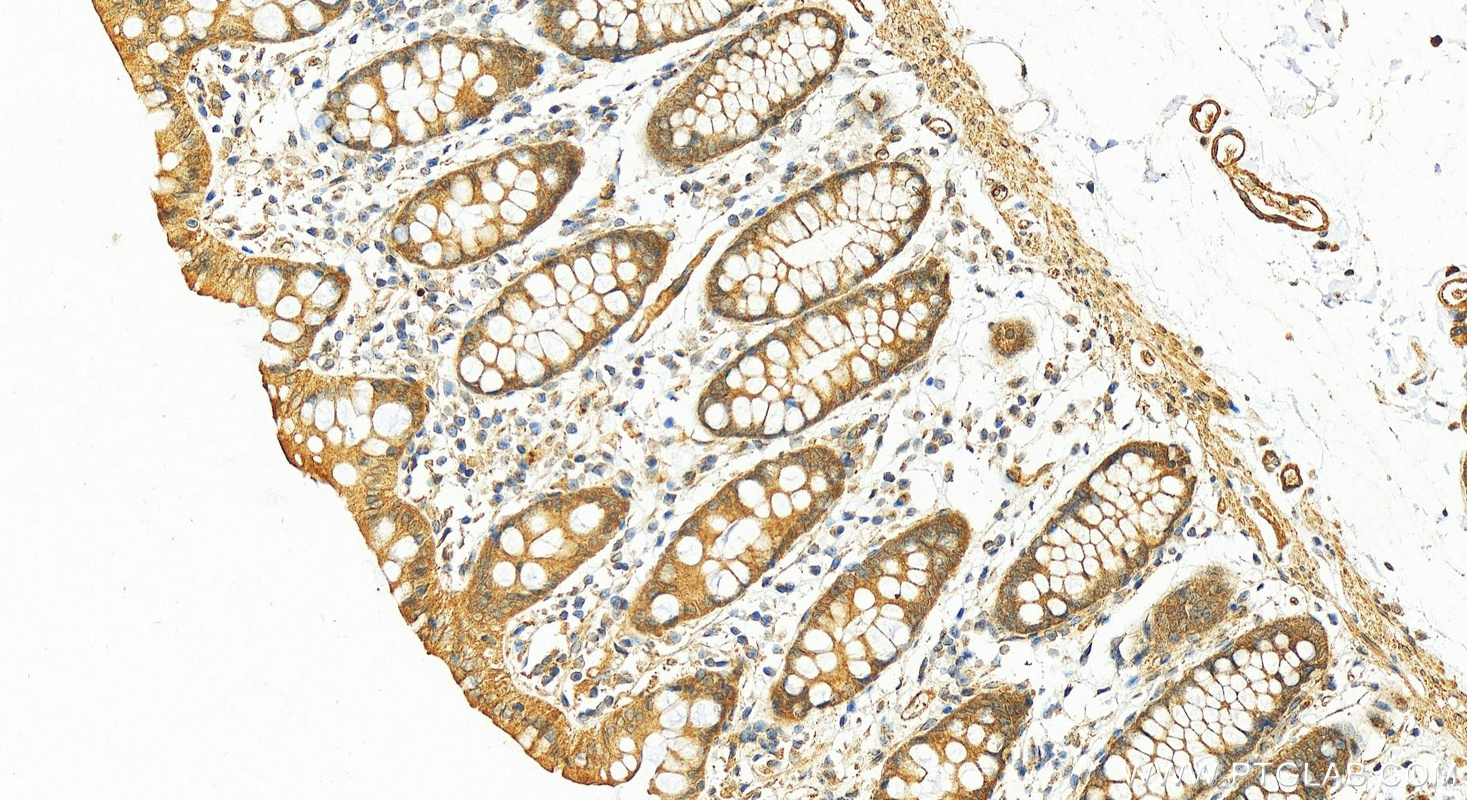 Immunohistochemistry (IHC) staining of human colon tissue using IL-1RA Polyclonal antibody (10844-1-AP)