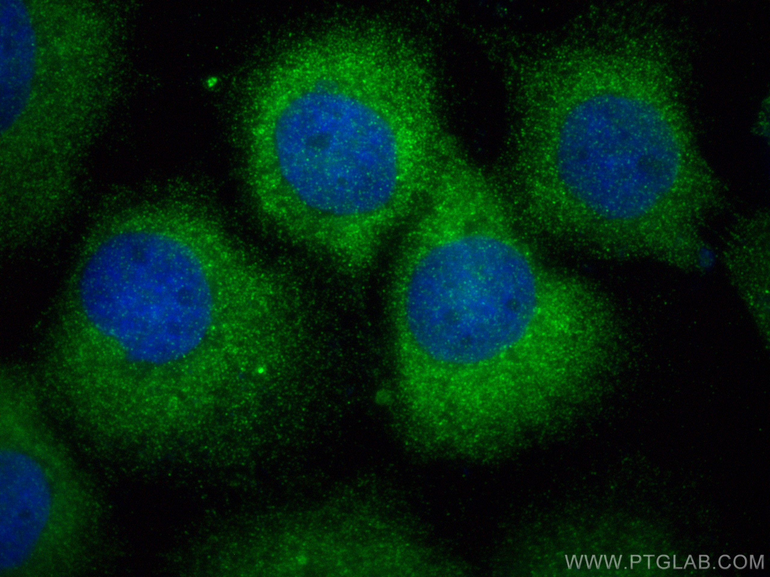 Immunofluorescence (IF) / fluorescent staining of A431 cells using IL-1RA Polyclonal antibody (10844-1-AP)