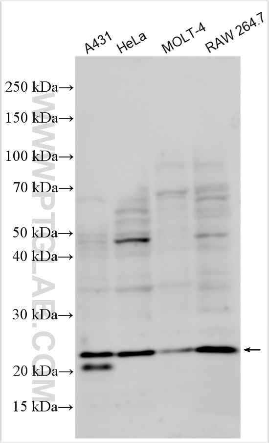 Western Blot (WB) analysis of various lysates using IL-1RA Polyclonal antibody (10844-1-AP)