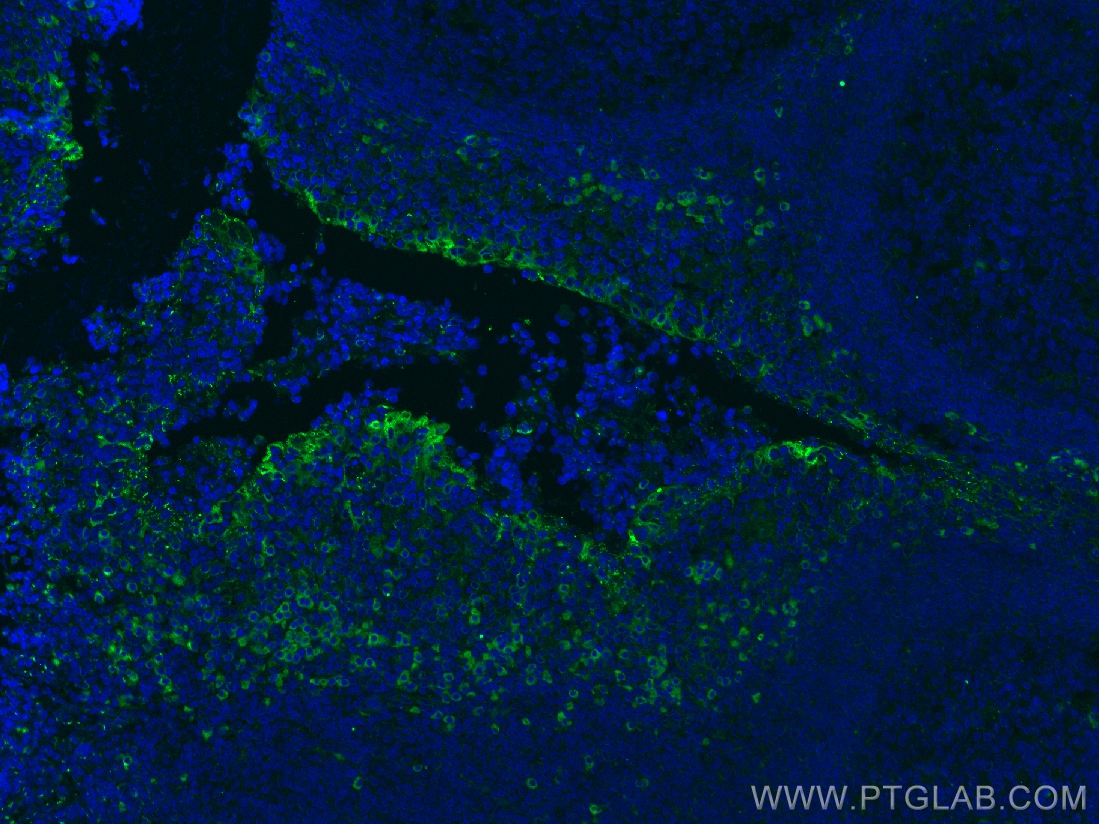 Immunofluorescence (IF) / fluorescent staining of human tonsillitis tissue using IL-2 Monoclonal antibody (60306-1-Ig)