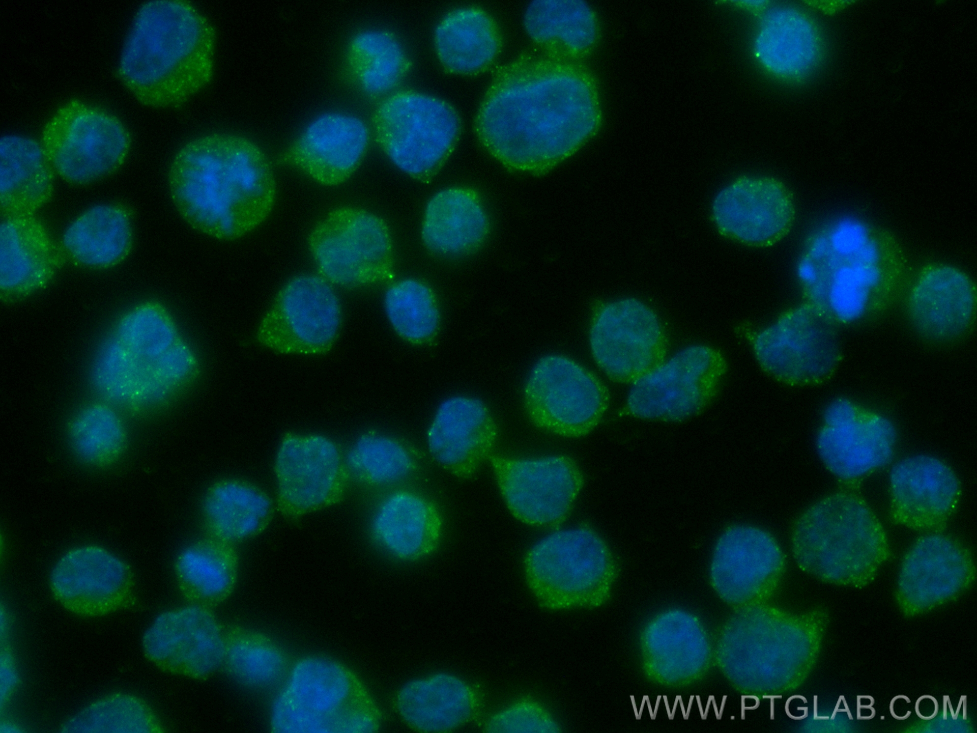 Immunofluorescence (IF) / fluorescent staining of Jurkat cells using IL-2 Monoclonal antibody (60306-1-Ig)